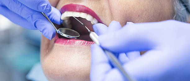 Best Emergency Root Canal Treatment in South Bend, IN